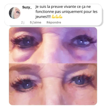 Glowmoon | Appareil Soin Contour des Yeux | Anti-Poches sous les yeux & Anti-Cernes Glowleen Suisse