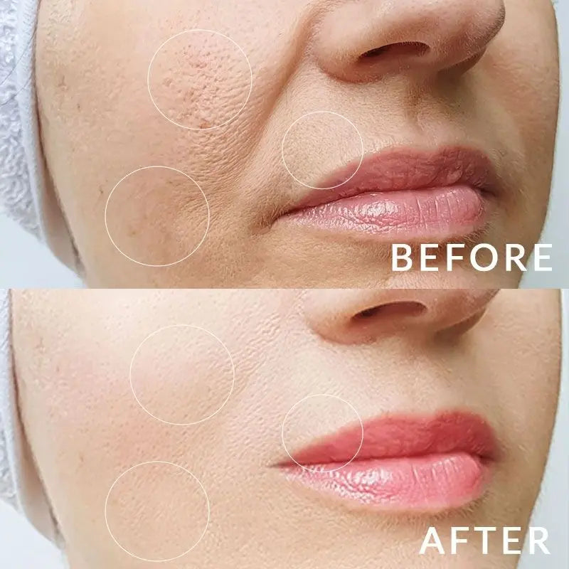 Glowlift Define | Appareil raffermissant visage Glowleen Suisse