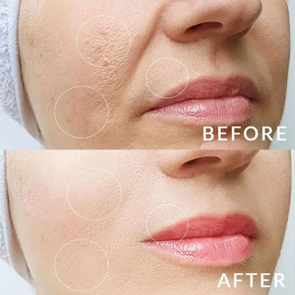 Glowlift Define | Appareil raffermissant visage Glowleen Suisse